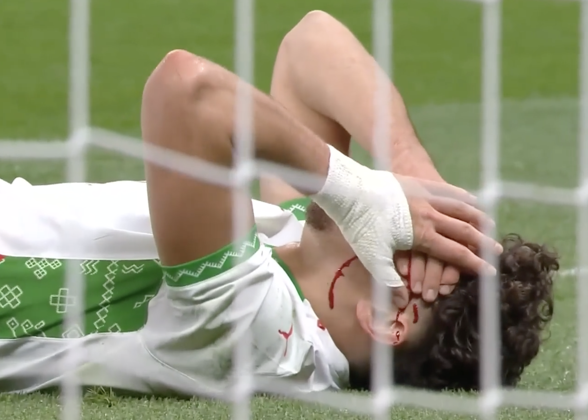 HORRIFIC! El Aynaoui left bloodied after nasty head collision